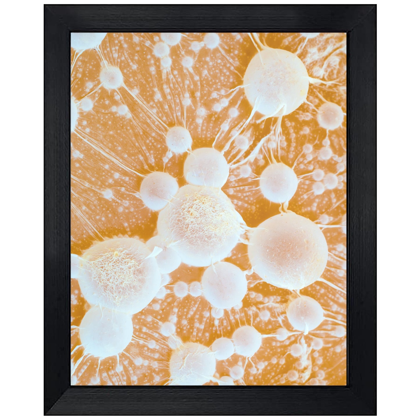 Cancer Tumors with Metastases Oncology Oncologist Doctor 8"x10" Wall Art Print